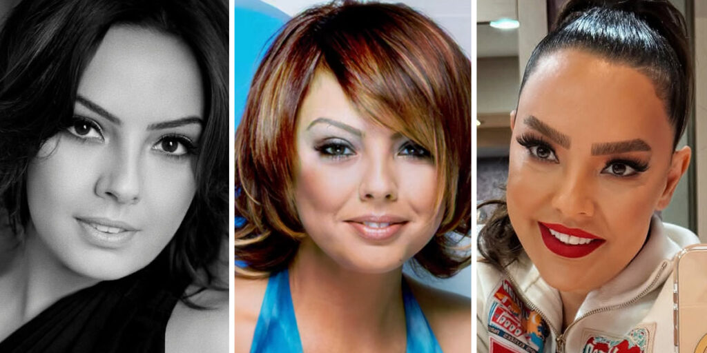 عکس ابرو گوندش قبل از عمل زیبایی عکس ابرو گوندش قبل از عمل زیبایی